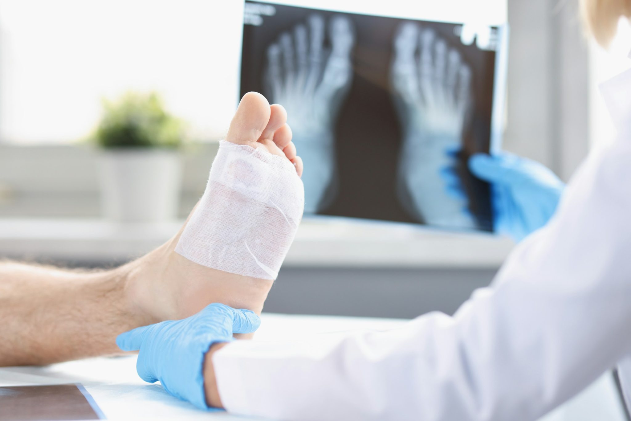 Post-surgery care for achilles tendon repair: essential tips for recovery